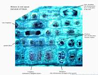 01_Mitosis in Onion toot tip x1000_labels.JPG